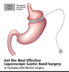 Laparoscopic gastric band process is the proven & most widely used weight loss solution. At Tasmania Anti-Obesity Surgery, we provide this minimally invasive surgery that reduces the weight without cutting or stapling of the stomach which results less pain & less time off from work.