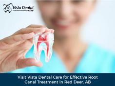 Looking for a root canal dentist in Red Deer, AB? Visit Vista Dental Care. We offer safe and effective root canal treatment using modern anaesthetics and technology. Get in touch today! 