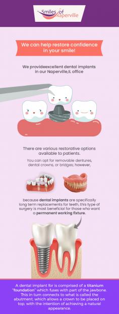 Fix your missing, broken, or chipped teeth with quality dental implants in Naperville, IL from Smiles of Naperville. We specialize in providing natural-looking tooth replacements at affordable prices. Get in touch today! 