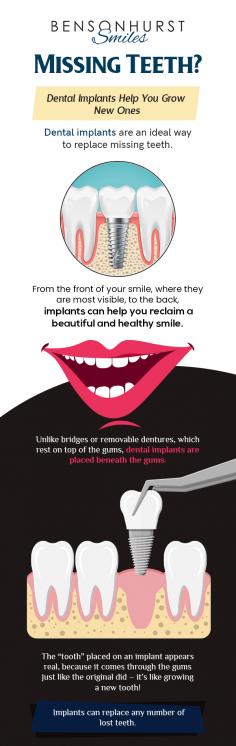 Whether you have one or more missing teeth, choose Bensonhurst Smiles dental clinic for their replacement. Our dental implants help you reclaim a beautiful and healthy smile. 