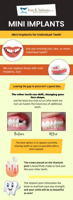 Are you missing one, two or more teeth? Get them replaced with mini implants from Dr. Ivan K. Salmons, DDS. They help in maintaining your jaw strength and giving you a beautiful smile again. 
