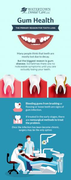 Suffering from bleeding gums? Look no further than Watertown Dental Care as we provide an easy and non-surgical gum disease treatment in Watertown, SD. With the help of the latest technology, we are passionate about arresting the gums, whether the infection is in the starting stage or an advanced stage. 