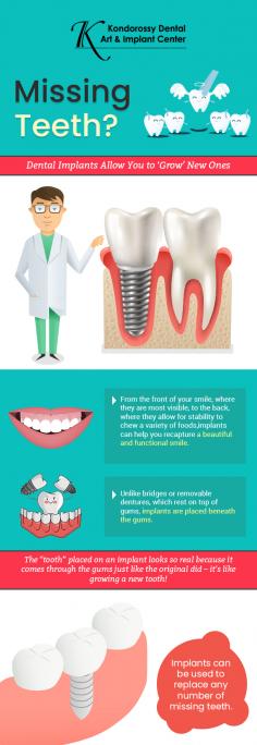 Whether you have lost one or more teeth, dental implants from Coloman E Kondorossy DMD FAGD are an excellent way to replace them. From implant placement to its fabrication, he handles all by own without referring to another office.
