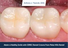 Restore you smile with CEREC dental crowns from Palos Hills Dental. We specialize in offering one-visit crowns to make your dentist visit comfortable and less waiting. 