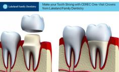 At Lakeland Family Dentistry, we offer convenient One-Visit Crowns to restore your damaged teeth. With on-site computer-aided design and milling device, we can create a permanent crown in just a few minutes. 