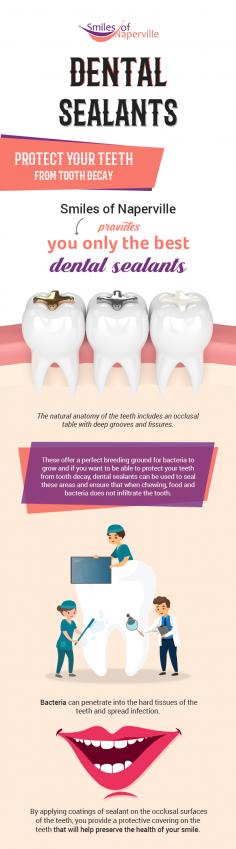 Our kids’ dentist at Smiles of Naperville is pleased to provide the best dental sealants to protect your kids’ teeth from tooth decay and plaque. Sealants applied by our dentists will continue to protect your teeth for coming years. 