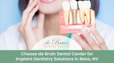 Looking for an implant dentist in Reno, NV? Unlike bridges or removable dentures, implants look life-like to give you a natural feel. From implant creation to its actual placement, you'll not need to be referred to another practice.
