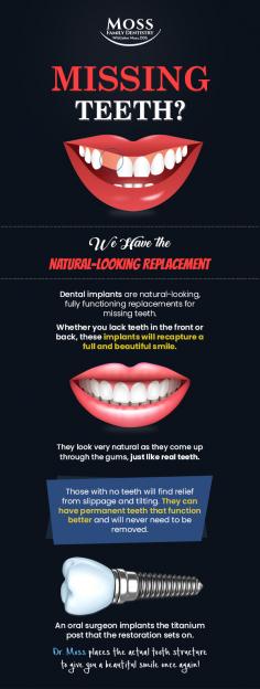 Dental Impants are fully functioning replacements and natural-looking solution for missing teeth. Dr. Moss at Moss Family Dentistry in Maryville, TN offers quality dental implants, custom-designed dentures, and overdentures to make your life much easier. Schedule your appointment today!