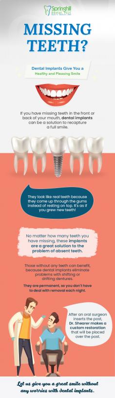 Cure your damaged teeth and bring your smile back by getting the highest quality dental implant treatment from Springhill Dental. Here, we design modern implants that will perfectly fit in your mouth. 