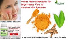 Curcumin has a lot of therapeutic properties used in Natural Remedies for Polycythemia Vera. These are having against oxidating, germicide properties. Likewise, these cases assist in upgrading the force of resistance of the individuals.