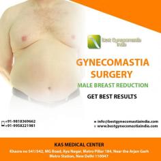 A gynecomastia or male breast reduction surgery is the most effective cosmetic surgical procedure among men to correct enlarged male breasts. Many men develop enlarged breasts due to various reasons like heredity, side effect of some certain medication, aging or any other unspecified reasons.
Dr. Ajaya Kashyap is US board certified plastic surgeon and experienced in performing gynecomastia surgery.During your consultation, Dr. Kashyap will help determine which technique is best for you. Call Dr. Kashyap today at (981) 836-9662 to schedule your consultation.

CONTACT US:-

WhatsApp Direct Link: https://api.whatsapp.com/send?phone=919818369662
If you are interested you can book an appointment online: https://www.bestgynecomastiaindia.com/contact.php
Mobile: +91-9818369662, 9958221981
Email: info@bestgynecomastiaindia.com
Now New Address: Khasra no 541/542, MG Road, Aya Nagar, Metro Pillar 184, Near the Arjan Garh Metro Station, New Delhi 110047 (India)
#gynecomastia #malebreastreduction #cosmeticsurgery #plasticsurgeon #gynecomastiaclinic #Drkashyap #Delhi #India

