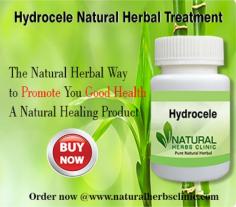 Herbal Treatment for Hydrocele read about Symptoms and Causes. Hydrocele is a painless buildup of watery fluid around one or both testicles that causes the scrotum or groin area to swell.
