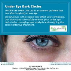 UNDER EYE DARK CIRCLES is a common problem that can affect anybody at any age.
But whatever is the reason they affect your confidence. Our physicians successfully  remove your under eye dark circles through proper analysis and assigning the correct effective treatment.  
Visit: https://www.skintreatmentsindia.com
Now New Address: Khasra no 541/542, MG Road, Aya Nagar, Metro Pillar 184, Near the Arjan Garh Metro Station, New Delhi 110047 (India)
#drajayakashyap #bestcost #skintreatment #darkcircle #undereyedarkcircle #nonsurgical #filler #peels #Carboxytherapy
