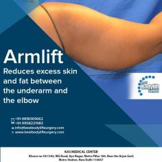 Arm Lift Surgery Delhi is the procedure to reduce extra fat from your body. Some people have the problem of saggy arms and wants to tighten their skin this the only best option to tighten the skin through arm lift surgery treatment. 

Please visit our website at www.bestbodyliftsurgery.com or write to us at info@bestbodyliftsurgery.com