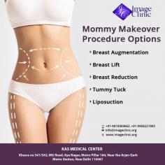 Mommy Makeover surgery is a name given to a variety of cosmetic surgeries that can be done to tighten, firm, and rejuvenate parts of the body that change as a result of pregnancy and childbirth. Tummy tuck, breast augmentation, liposuction, arm, buttock or thigh lift, and vaginal rejuvenation are all popular elements of a mommy makeover, but the results are customisable to your wants and needs.

For more details and see before & after our national & international patients. 

Call now on +91-9958221983 to get instant appointments and take the opportunity to avail knowledgeable consultation of Dr. Ajaya Kashyap

Visit: https://www.imageclinic.org/mommy-makeover-packages.html

#PlasticSurgery #Imageclinic #Surgery #Transformation #Mommy #liposuction #tummytuck #breastsurgery #mommymakeover #beforeandafter
