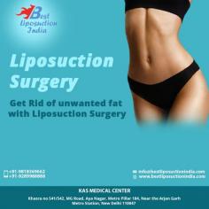 If you have been thinking about getting a liposuction surgery in Delhi contact us for an appointment where we can discuss your requirements in more details. 
Share your whatsapp number, contact number or email id to get immediate help. You can also visit www.bestliposuctionindia.com to know details
#PlasticSurgery #Surgery #Transformation #Mommy #Liposuction #Bodyjet #Vaserliposuction #CosmeticSurgeryIndia #Whatsapp
