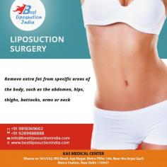 Liposuction is cosmetic surgery in which deposits of fat are removed to reshape or reduce one or more areas of the body. Common areas targeted include thighs, buttocks, abdomen, arms, neck and under the chin. 
If you have been thinking about getting a Liposuction Surgery in India contact us for an appointment where we can discuss your requirements in more details. You can call us at +91-9958221983 or email us at info@bestliposuctionindia.com. Our practice accommodates out of town and international patients who fly in for surgery as well as those who live in Delhi.
Check out more details: https://www.bestliposuctionindia.com
#PlasticSurgery #Surgery #Transformation #Mommy #liposuction #tummytuck #breastsurgery
