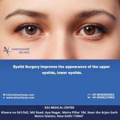 Eyelid Surgery, medically known as Blepharoplasty, helps to rejuvenate the lower and upper eyelids. Sagging eyelids make you appear tired and older than your actual age.

For more information about Eyelid surgery, or to schedule a consultation, please call Dr. Kashyap Clinic (KAS Medical Center) today at +91-9818369662 or use our online appointment request form.

Book an Appointment: www.drkashyap,com
Whatsapp: https://api.whatsapp.com/send?phone=919289988888
#Eyelid #loweeyelid #lowerblepharoplasty #eyebags #beforeandafter #DrKashyap #CosmeticSurgery #PlasticSurgeon #Delhi #India

