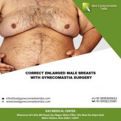 Many men develop enlarged breasts due to various reasons like heredity, side effect of some certain medication, aging or any other unspecified reasons. The breast reduction surgery helps remove excess fat and tissues to provide a firmer and flatter contour to the chest.
Contact us anytime with any questions you may have, or to schedule your consultation for gynecomastia surgery in Delhi, India.

CONTACT US:-
Dr. Ajaya Kashyap
WhatsApp:
https://api.whatsapp.com/send?phone=919958221981
Mobile: +91-9818369662, 9958221981
Web: www.bestgynecomastiaindia.com

#gynecomastia #plasticsurgery #malebreastreduction #breastreduction #gyneco #men #cosmeticsurgery #beauty #plasticsurgeon #surgery #happypatient #realpatient #review #realself #lifestyle #traveling #travel #instagram
