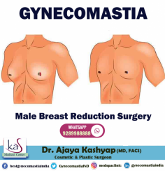 Gynecomastia surgery is performed by our expert plastic surgeon, Dr. Ajaya Kashyap. He is regarded as the best gynecomastia surgeon India due to his 26 years of surgical experience and being a Triple American Board certified Plastic Surgeon. The search to get the best gynecomastia surgery leads you to have your male breast reduction. Dr. Ajaya Kashyap, your specialist gynecomastia surgeon, may perform the procedure with liposuction and gland excision, or just liposuction alone.

Get the best Cosmetic and Plastic surgery in India at KAS Medical Center. For any kind of enquire about, gynecomastia procedure 

CONTACT US:-
Dr. Ajaya Kashyap (MD, FACS)
Web: www.bestgynecomastiaindia.com
YouTube: https://www.youtube.com/watch?v=vIHgL9cj7QQ

#gynecomastiasurgery #bestgynecomastiaindia #vaserliposuction #drkashyap
