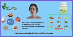 Bell's palsy is a situation in which a temporary weakness or paralysis of the muscles occurs in the face. It can happen when the nerve that manages your facial muscles turns in to inflamed, or compressed. Bell's palsy can be controlled with Natural Remedies for Bell's palsy without any side effects.