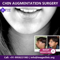 Chin augmentation has been and continues to be a popular surgery even today because it is a safe and easy surgery for the patient while giving outstanding results which produce dramatic, visible changes in the shape of the face.

Contact Dr. Kashyap Clinic (KAS Medical Center) at +91-9958221983, 9958221981 to book a consultation or ask us a question. Check out more details: www.imageclinic.org

#chinaugmentation #chinfiller #chinimplant #cosmeticsurgery #plasticsurgeon #chinaugmentationdelhi #chinimplantcostinindia #Drkashyap #Delhi #India #medicaltourism


