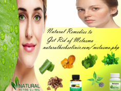 Another good Natural Remedies for Melasma is turmeric. Turmeric is useful in curing melasma because it contains antioxidants and skin whitening properties.