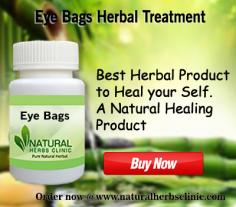Natural Remedies for Eye Bags	

Eye Bags, also recognized as swelling or puffy eyes refer to the appearance of puffiness in the tissues that are present around your eyes called orbits. Natural Remedies for Eye Bags can help to get rid of the infection.
https://www.naturalherbsclinic.com/Eye-Bags.php	
