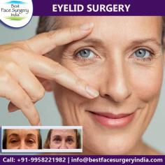 Removes excess fat, muscle and skin from upper and lower eyelids giving them a more awake and youthful while improving the contour.
If you have been thinking about getting a eyelid surgery in Delhi contact us for an appointment where we can discuss your requirements in more details.
Please Call or Whatsapp: +91-9818963662 or +91-9958221982.
Email: info@bestfacesurgeryindia.com
Web: www.bestfacesurgeryindia.com

#blepharoplasty #lowereyelid #uppereyelid #eyelidsurgery #cosmeticsurgery #plasticsurgeon #Delhi #India #eyebags #beforeandafter #DrKashyap
