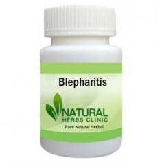 Natural Remedies for Blepharitis	

Blepharitis is an eyelids inflammation in which they turn into red, irritated, and itchy with dandruff-like scales that form on the eyelashes. Utilization of Natural Remedies for Blepharitis is a great idea to recover the condition.	
https://www.naturalherbsclinic.com/blepharitis.php	
