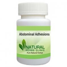 Herbal Treatment for Abdominal Adhesions read about the Symptoms and Causes. Abdominal Adhesions are bands of scar tissue between abdominal tissues and organs.
