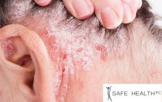Safe Health & Med Spa Lansing can offer a wide range of options for wart treatment. If your warts are getting troublesome, cosmetic concern, or spreading at a high pace, a dermatologist specialize in wart removal is highly recommended. To learn more about your treatment options, Schedule a Consultation with Dr. Fatteh Today. 