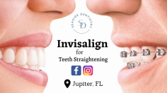 Choose a Customized Aligners for Teeth

Easy way to straighten tooth by invisalign procedure to bring back a natural smile in a painless way by a dentist. For more info - Info@seasidedentistryjupiter.com.
