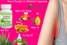 Neem oil has been utilized for a long time in Natural Remedies for Hidradenitis Suppurativa and other skin conditions like acne. It can assist decrease bacteria, redness, and irritation. It also contains a high fatty-acid content, which might support healing.