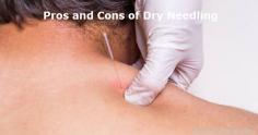 The pros and cons of Dry Needling Therapy. Trigger Point Dry needling is the new frontier for treating musculoskeletal pain. A growing number of physical