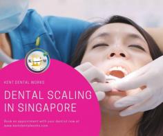 Treatment for Dental Scaling in Singapore - Kent Dental Works

If you have chronic periodontal disease, your dentist will recommend dental scaling treatment.  Your gums are drawn away from your teeth due to the formation of bacteria leading to large pockets between your teeth and gums. Bacterias continue to grow there and, if left untreated, may lead to teeth loss, loose teeth. Dental scaling in Singapore is usually an outpatient procedure, and your appointment frequency varies depending on the severity of the condition. If the severity of the scaling is more, your dentist may use anaesthetic to reduce discomfort. The procedure starts with teeth scaling, scraping plaque from the teeth, and root planing. Your dentist will recommend additional treatment based on the severity of the condition. Speak to our dentist at Kent Dental now to learn more about the dental scaling treatments.