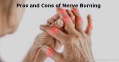 Pros and cons of Nerve Burning. Nerve burning through radiofrequency ablation is a surgical treatment that destroys part of nerve tissue to block nerve impulses