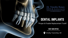Dental Treatment For Missing Teeth 

Our experts will replace the tooth under the procedure of implant processing. The method is to fix the metal screw into the tooth layer and set the ceramic teeth as an artificial part in the mouth. Want to know more? Call us at (586) 786-6060.