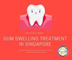 Swollen gums cause serious issues and it is essential to pay more attention to your gums to maintain your overall health. Gum diseases are more common when you have poor oral hygiene and it leads to swollen gums associated with bleeding. There are no specific reason for gum problems and it is also related to other health issues. Maintaining a good oral hygiene helps to minimise gum disease. For many people, inflammation is not painful and when treated earlier, it can heal with good dental practice. Learn more about the treatments available for Gum Swelling Singapore by visiting our clinic and consulting our onsite doctors.