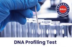 DNA Profiling is the procedure of deciding a person's DNA characteristics based on the isolation and identification of variable elements in the DNA sequence, which is unique to every person except identical twins. At DNA Forensics Laboratory Pvt. Ltd., we provide 100% accurate and trustworthy Dna Profiling Tests in India at affordable prices. Contact DNA Forensics Laboratory at +91 8010177771 and WhatsApp at +91 9213177771 to learn more about the test.