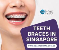 What are the benefits of wearing teeth braces? A better-looking smile is the first factor that comes to our mind when we think of teeth braces; teeth braces Singapore helps to give you extra confidence by boosting your appearance by straightening the teeth.  Teeth braces help to straighten your teeth which will make it easy to reach the clean spots thereby increasing the oral health. Learn more about the available teeth braces option with Coast Dental clinic in Katong.