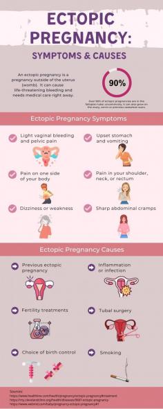 Ectopic pregnancy is a major gynecologic emergency, which results in significant morbidity for the mother and inevitable loss of the pregnancy.
Ectopic pregnancy can be hard to diagnose because symptoms often are like those of a normal early pregnancy. This infographic covers the symptoms and causes of ectopic pregnancy.  
If you think you're at risk for an ectopic pregnancy, meet with your gynaecologist to talk about your options before you become pregnant. If you are pregnant and have any concerns about the pregnancy being ectopic, talk to the best gynaecologist in Singapore— it's important to find it early. Your gynae might want to check your hormone levels or schedule an early ultrasound to ensure that your pregnancy is developing normally.
Source:  https://www.drlawweiseng.com.sg/blog/ectopic-pregnancy-symptoms-causes/

