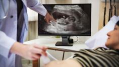 கர்ப்ப காலத்தில் கிரவுன்-ரம்ப் நீளம் (CRL) இன் முக்கியத்துவம் உங்களுக்கு தெரியுமா? | Do you know the Importance of CRL in Pregnancy? https://www.chennaiwomensclinic.in/do-you-know-the-importance-of-crl-in-pregnancy/