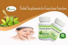 Using of Herbal Supplements for Granuloma Annulare can lessen the disease symptoms and help to keep the skin normal. https://www.londontime.co/granuloma-annulare-herbal-supplements-and-remedies-are-helpful/