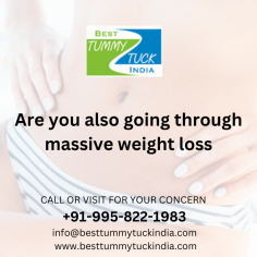 Are you also going through massive weight loss tuck your lose skin get perfect shape...
Connect here for more -
Call; +91-995-822-1983
Email: info@besttummytuckindia.com
website: www.besttummytuckindia.com