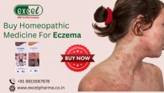 Eczema or Atopic dermatitis is a disorder in which patches develop on the skin. It is an inflammatory skin disease, causing itchiness and roughness, and can also result in blisters. Homeopathic Medicines for Eczema can effectively treat all its symptoms. E-Skin Drops (AKG - 22) is the best Homeopathic medicine for eczema and other skin problems. Contact Excel Pharma experts who may advise the Homeopathy medicine as per your skin type. For online or offline consultation, Call or WhatsApp at +91 9815567678. 