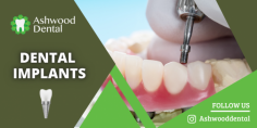 Get Proper Oral Care To Your Teeth

We provide a strong foundation for your teeth with perfect dental implants that are designed to blend in with other teeth and restore their function like normal teeth. For more information, mail us at emilymonroy.ashwooddental@gmail.com.