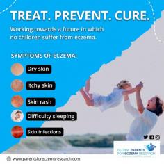 Global Parents for Eczema Research is a nonprofit Organization to provide treatment and cure eczema in children from moderate to severe. vision is to provide safe, effective treatments for every child who suffers from eczema and a future where fewer children develop the condition.