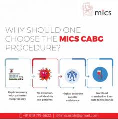 Minimally Invasive CABG is a new heart surgery option for patients with coronary heart disease. We perform this procedure using smaller incisions and less invasive tools, resulting in less pain, less blood loss and shorter recovery times.
For further information about Minimally Invasive CABG, visit: https://www.micsheart.com/mics-cabg/ 