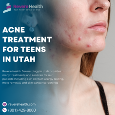 As Utah County’s leading dermatology practice, Revere Health Dermatology provides many treatments and services for our patients including skin contact allergy testing, mole removal, and skin cancer screenings. For more information on Acne Treatment in Utah, you can contact us at (801) 429-8000, or visit reverehealth.com/specialty/dermatology